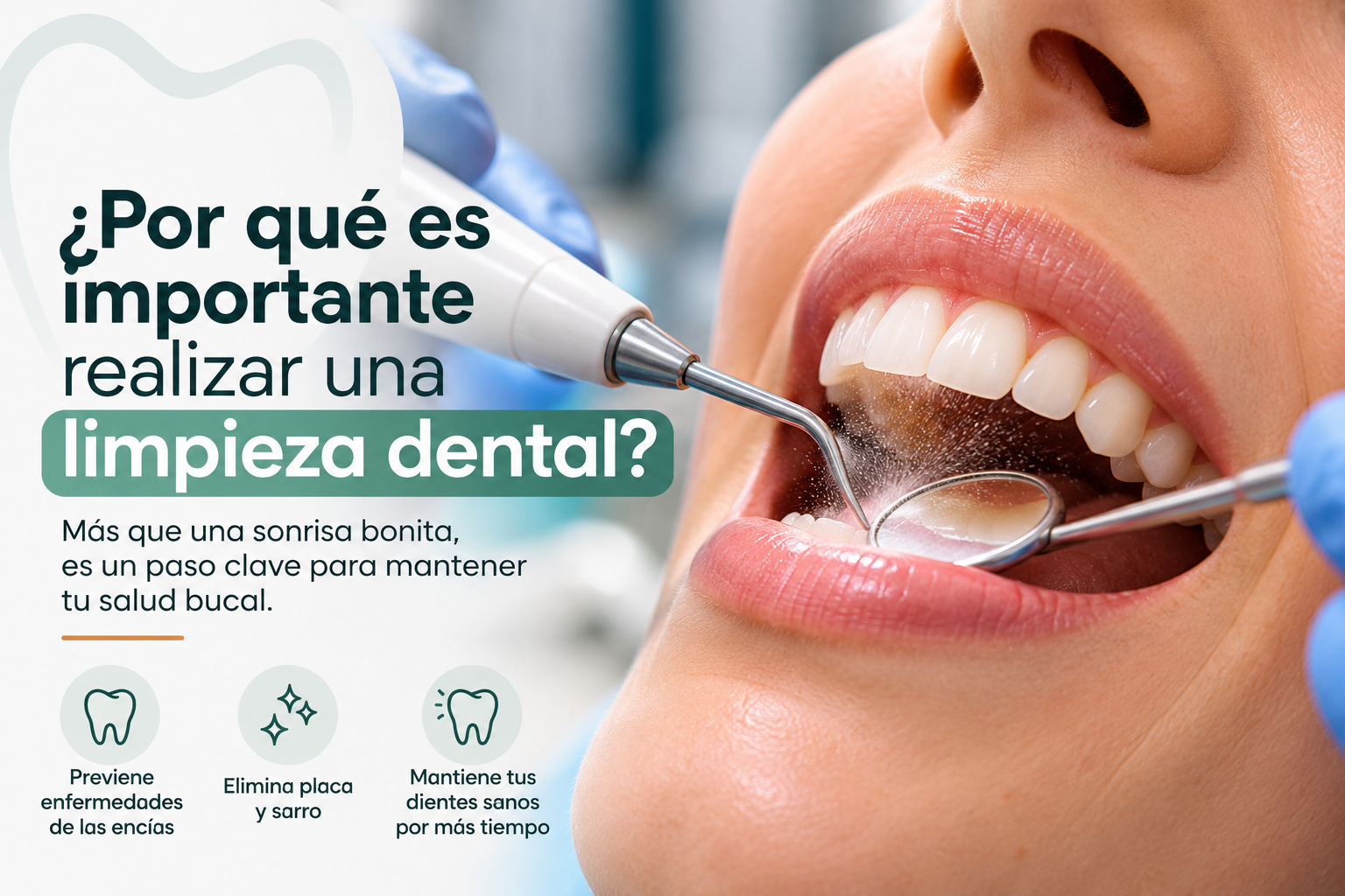 ¿Por qué es importante realizar una limpieza dental?